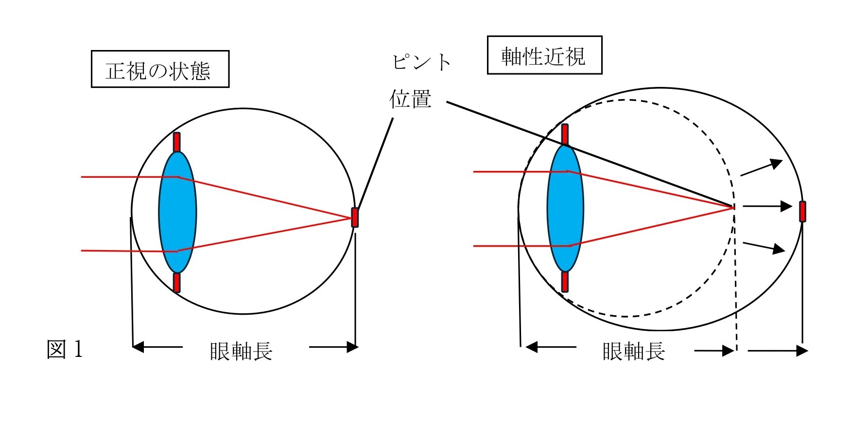 治療について